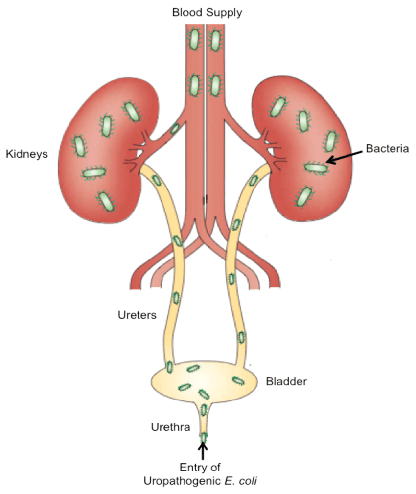 pathology-urinary-tract-infections-ditki-medical-biological-sciences